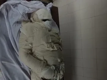 1600 डिग्री के पिघले लोहे से ठेकेदार की दर्दनाक मौत, आग की लपटों में घिरा भागता दिखा; स्टील प्लांट का वीडियो वायरल 1600 डिग्री के पिघले लोहे से ठेकेदार की दर्दनाक मौत, आग की लपटों में घिरा भागता दिखा; स्टील प्लांट का वीडियो वायरल